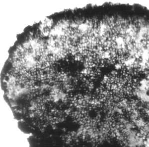 Sporangium with spores
