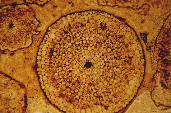 Transverse section of Rhynia