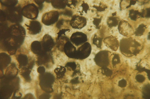 Tetrade of spores